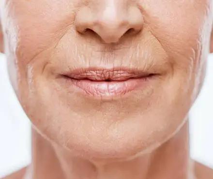 Wrinkles & Fine Lines - Cloud 10 Beauty