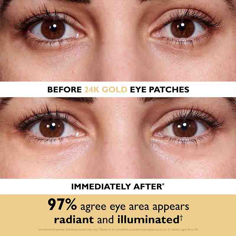 Before-and-after comparison of a woman's eyes, showing dark under-eye circles and sparse lashes in the top panel labeled 'BEFORE 24K GOLD EYE PATCHES' and brighter, more refreshed eyes in the bottom panel labeled 'IMMEDIATELY AFTER'. A beige banner at the bottom reads '97% agree eye area appears radiant and illuminated'.