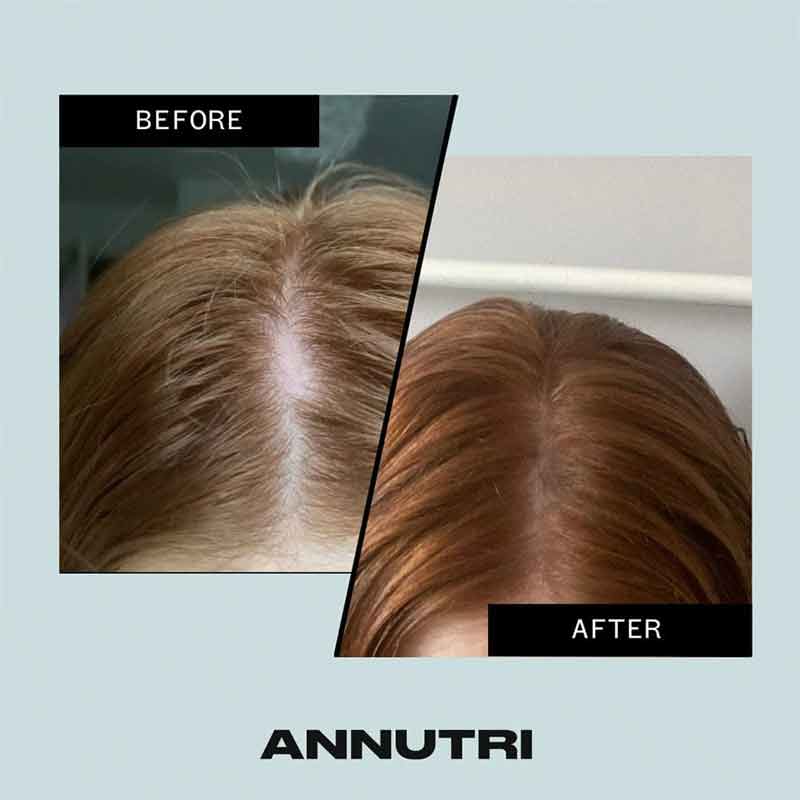 Annutri Grow it Before & After