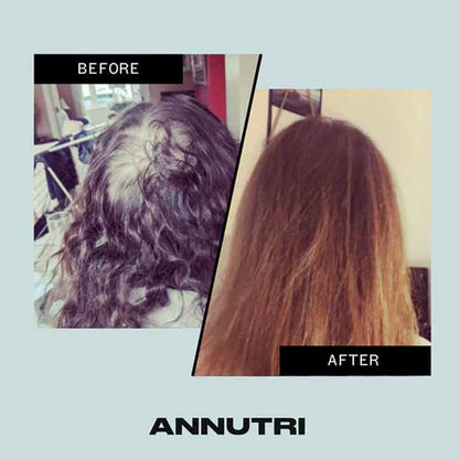 Annutri Grow it Before & After