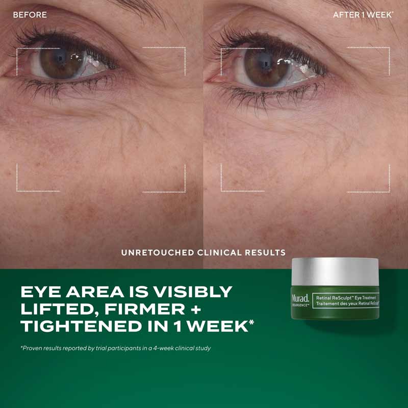 Murad The Retinal ReSculptors Gift Set Before and after