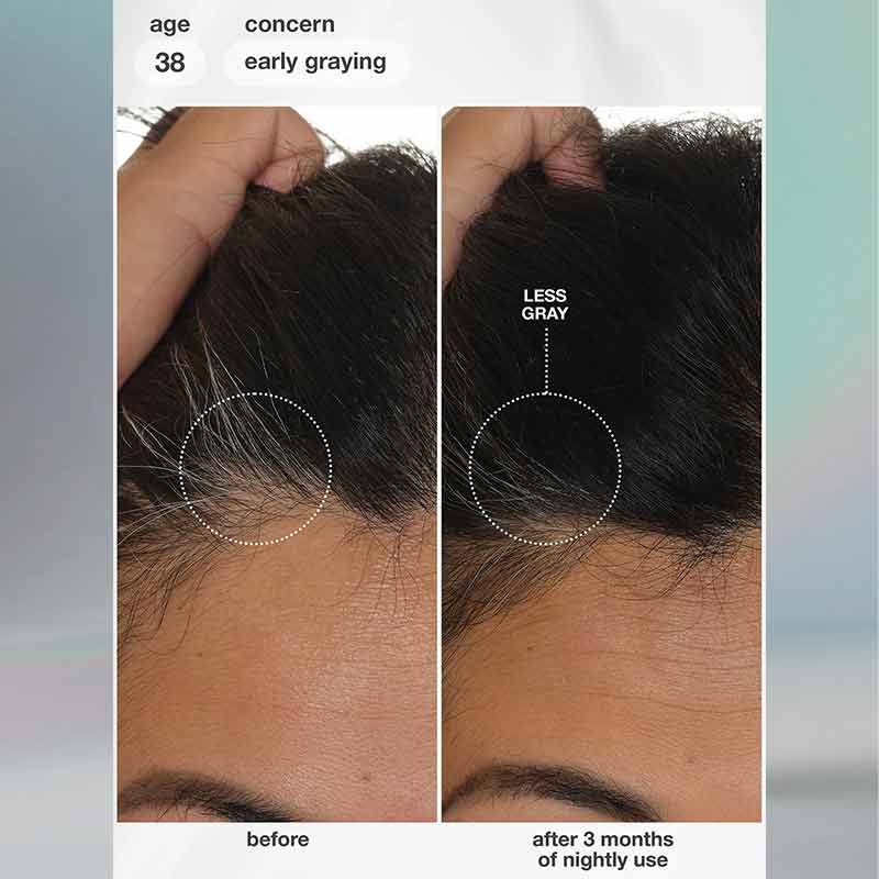 K18 FutureIQ Biomimetic Hair Longevity Serum