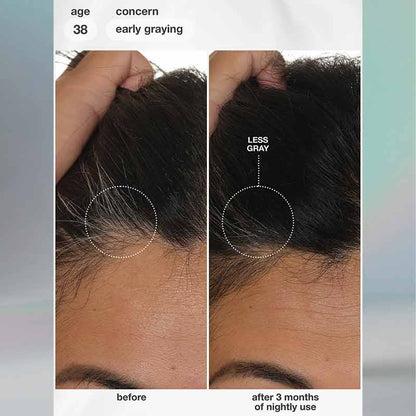 K18 FutureIQ Biomimetic Hair Longevity Serum