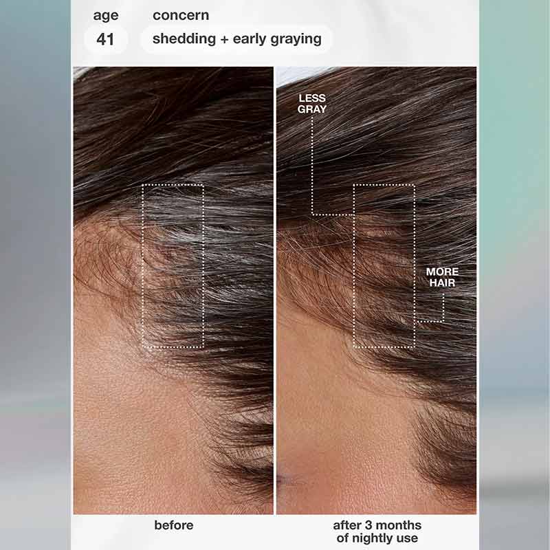 K18 FutureIQ Biomimetic Hair Longevity Serum