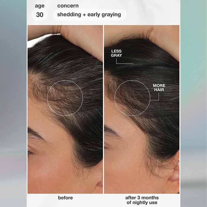 K18 FutureIQ Biomimetic Hair Longevity Serum