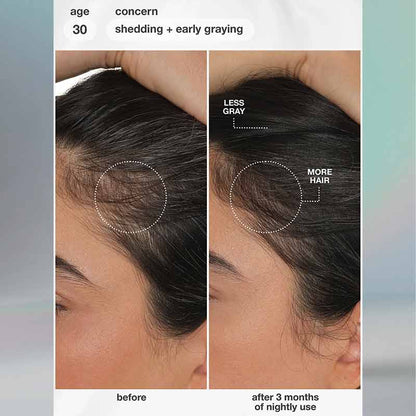 K18 FutureIQ Biomimetic Hair Longevity Serum