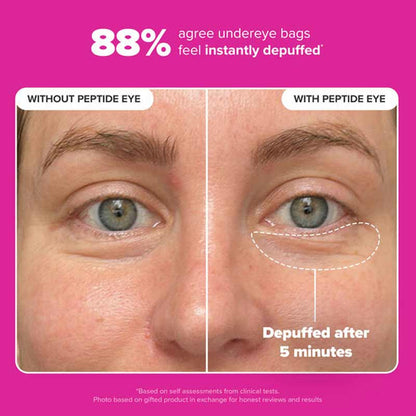 Paula's Choice Pro-Collagen Peptide Firming Eye Serum Results On Real Eye