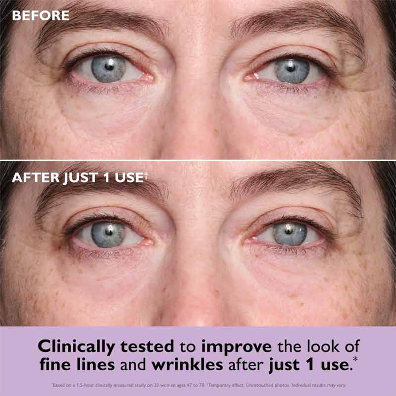 Peter Thomas Roth Instant FIRMx Collagen Infusion Tighteneing Eye Patches Before & After