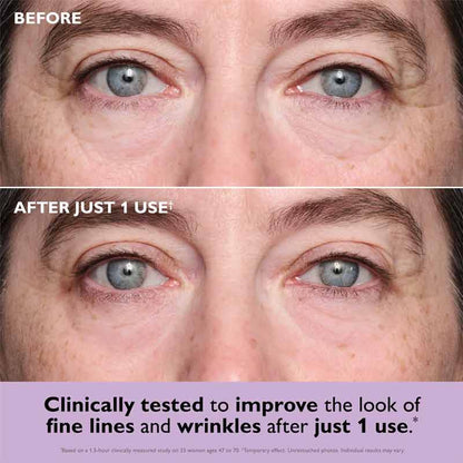 Peter Thomas Roth Instant FIRMx Collagen Infusion Tighteneing Eye Patches Before & After
