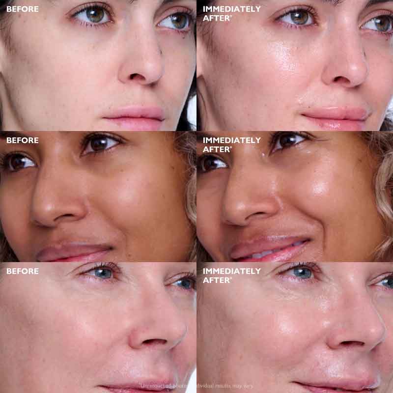 Peter Thomas Roth Collagen Skinjection Plumping & Firming serum Before & after