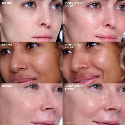 Peter Thomas Roth Collagen Skinjection Plumping & Firming serum Before & after