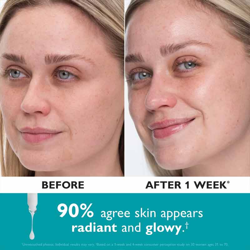 Peter Thomas Roth Collagen Skinjection Plumping & Firming serum before & after