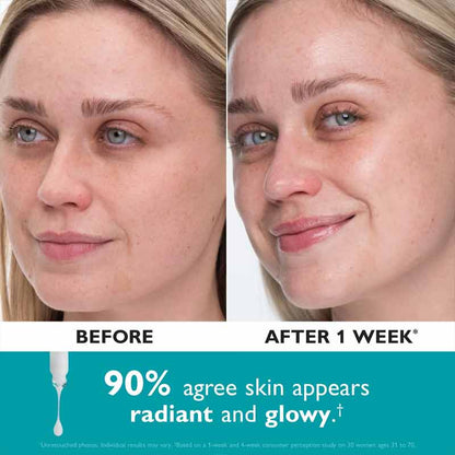 Peter Thomas Roth Collagen Skinjection Plumping & Firming serum before & after