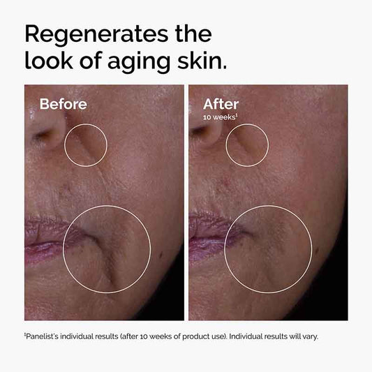 The Ordinary The Renewal Gift Set Before and After On Aging Skin