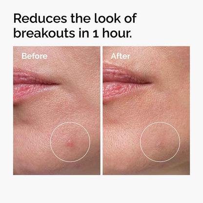 The Ordinary The Target & Treat Gift Set Before & After
