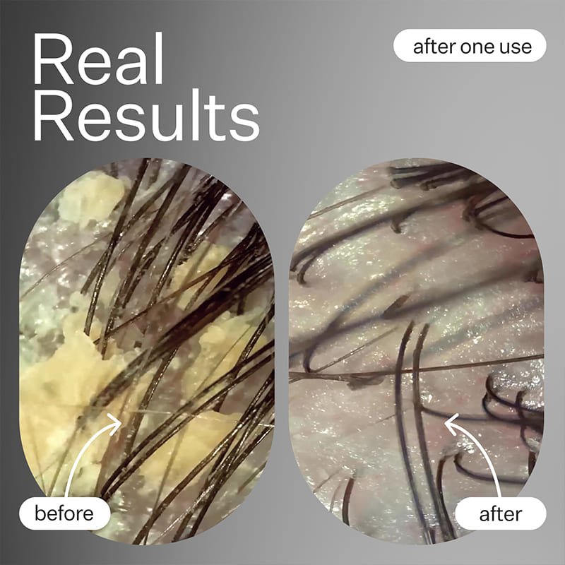 Act+Acre Cold Processed Scalp Detox | #1 Best Seller | Award-Winning Scalp Detox Treatment | lightweight pre-cleanse oil | Basil Leaf, Baobab Oil, Moringa Oil | healthier scalp | luscious locks.