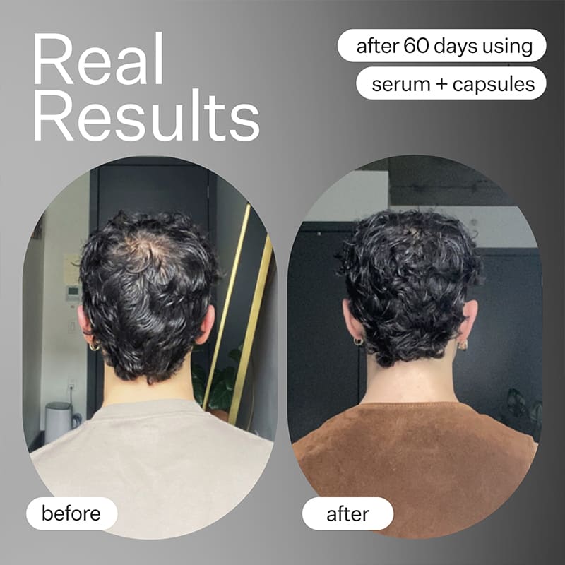 Act+Acre Cold Processed Stem Cell Serum | hair and scalp health | innovative serum | H2-Grow Complex™ | plant-based stem cells | hair follicle function | fuller, thicker-feeling hair.