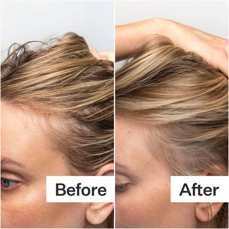 Act+Acre Oily Scalp System | Reduced oil and sebum | fresh | fuller looking hair | hair growth | reduced itchiness 