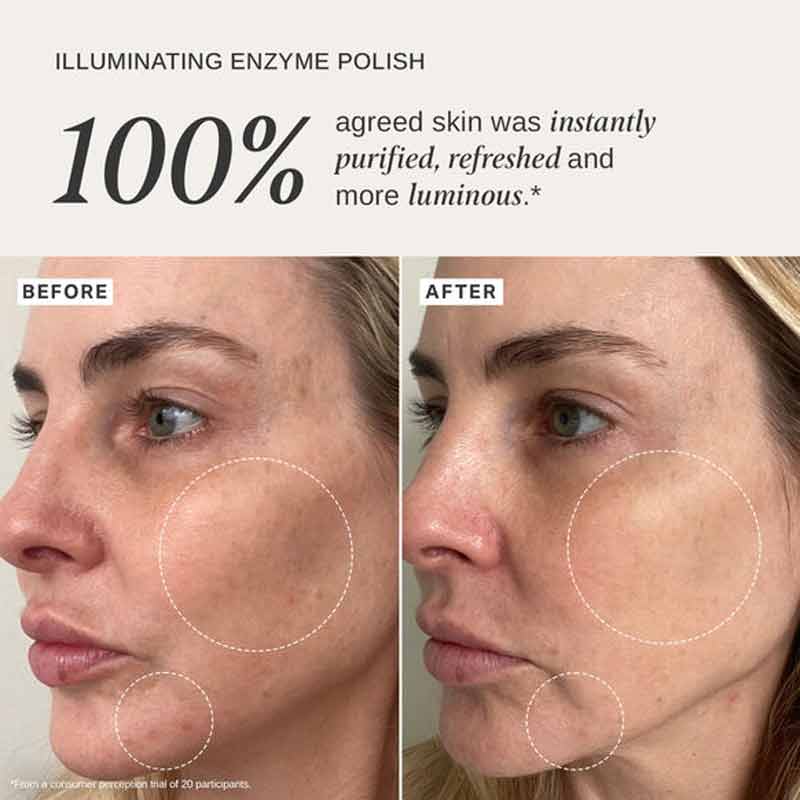 Alpha-H Illuminating Enzyme Polish with Native Rosella Flower Before & After Image