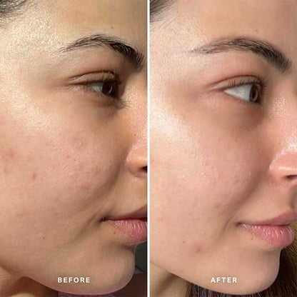 Alpha-H Liquid Gold Exfoliating Treatment With 5% Glycolic Acid, exfoliating facial toner