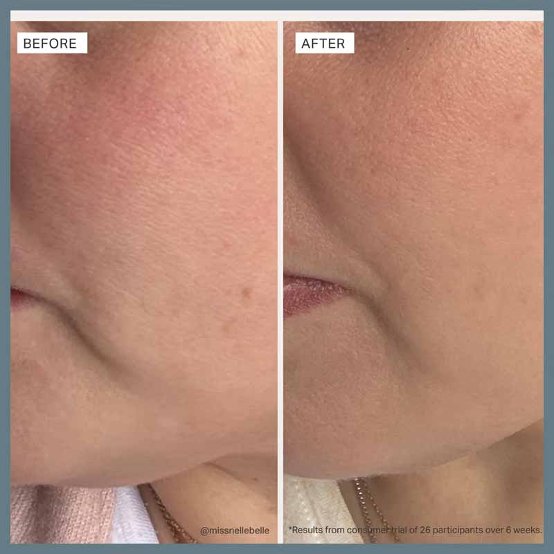 Alpha-H Multi-Peptide Revitalise Serum Before & after