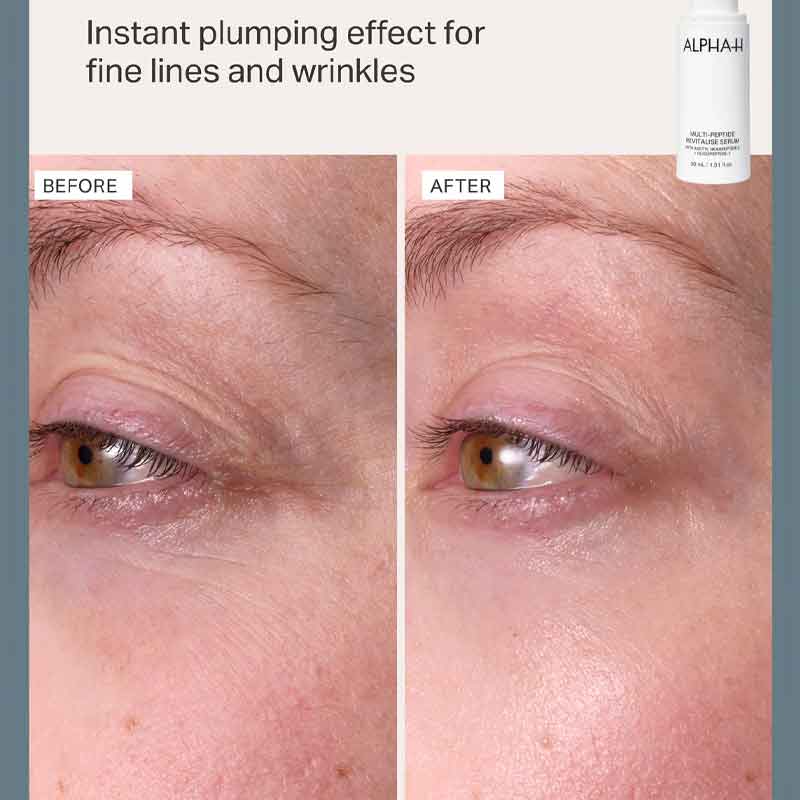 Alpha-H Multi-Peptide Revitalise Serum Before & After