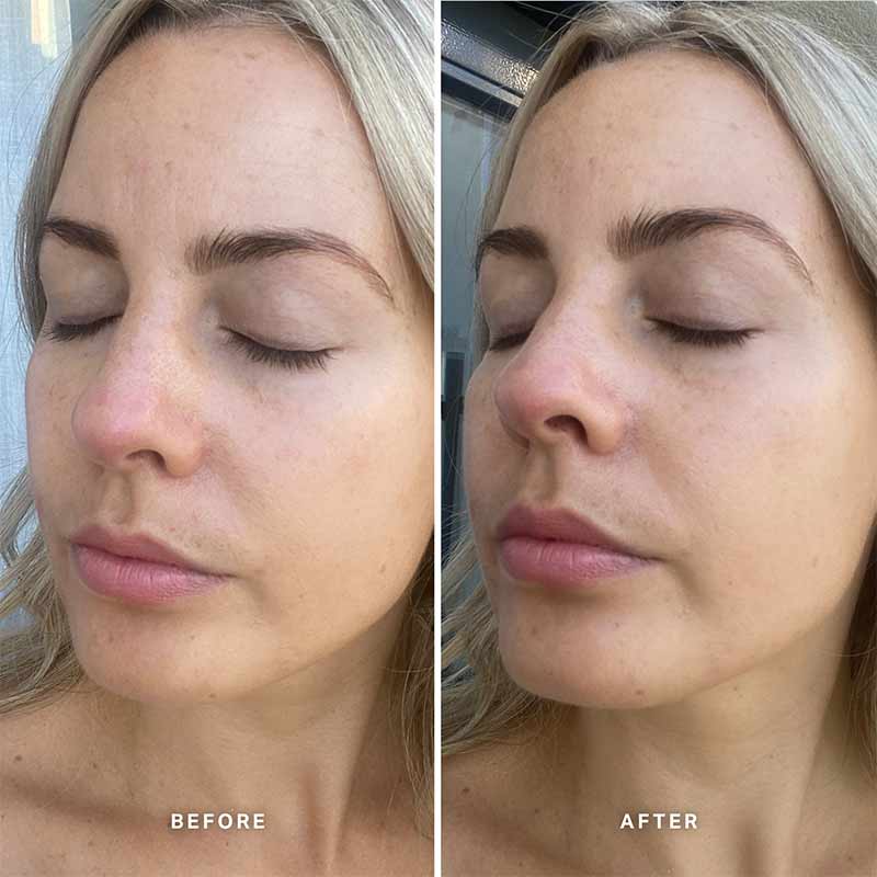 Alpha-H Vitamin E Serum with 1% Ceramide Complex | 4 week trial using vitamin e alpha h