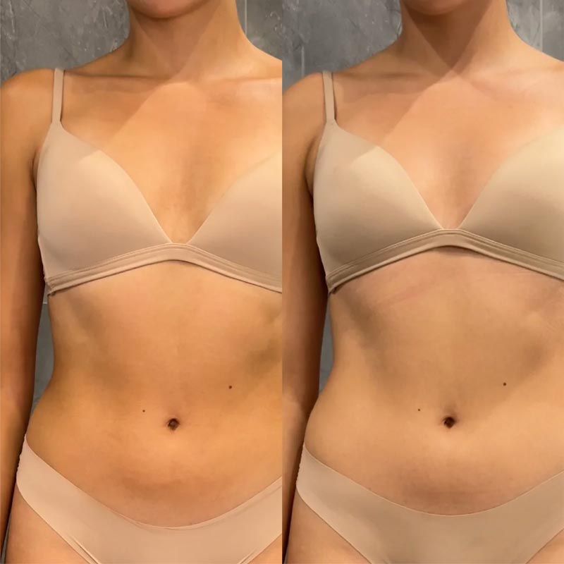 Bare by Vogue Express Tan Removal Gel Before & After
