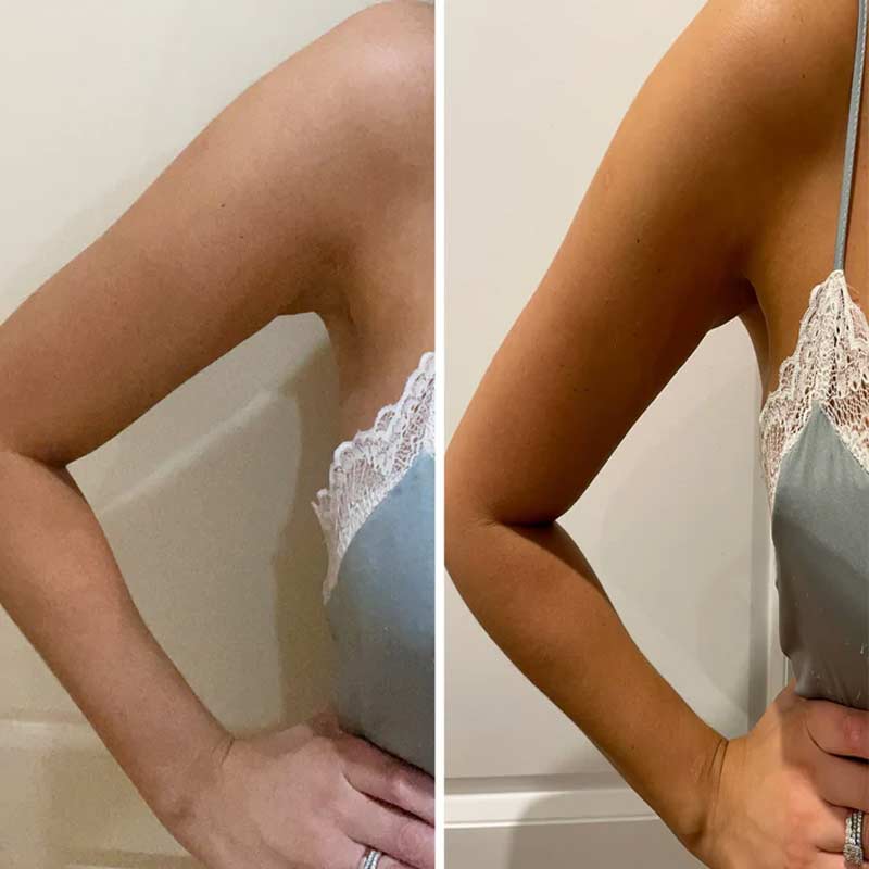 Beauti Edit Luxury Tan Mousse | 3-in-1 Self-Tanning Foam | tan, treat, hydrate | dark | self tan | foam | natural | gorgeous | glow | hydration | skin care