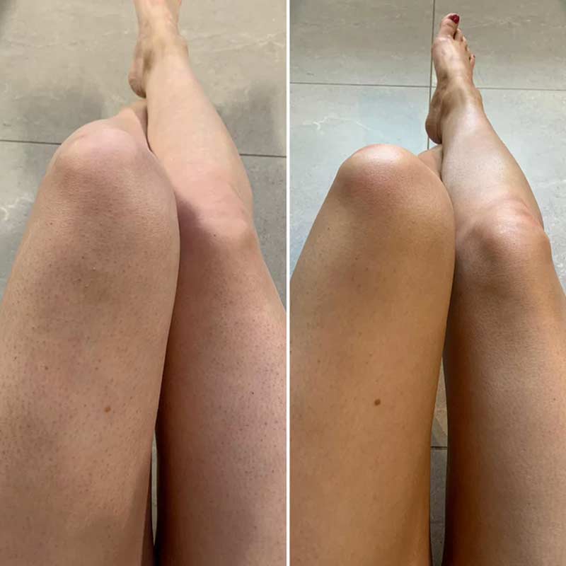 Beauti Edit Luxury Tan Mousse | 3-in-1 Self-Tanning Foam | tan, treat, hydrate | before | after | results | dark | self tan | hydrated | natural | radiant | sheen 