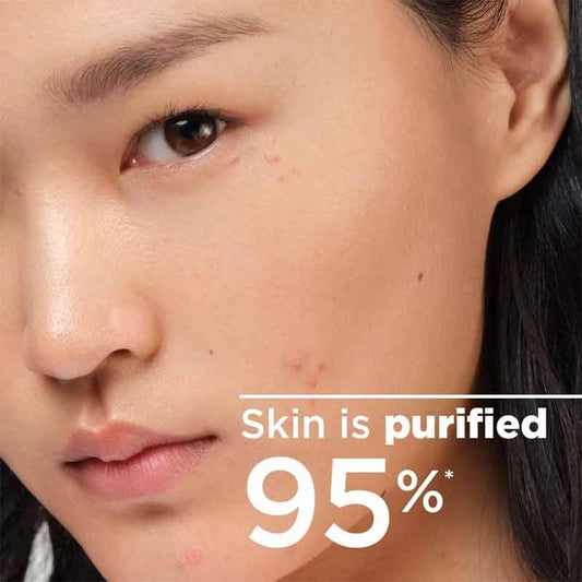 Bioderma Sebium H2O Purifying Micellar Water Model Image