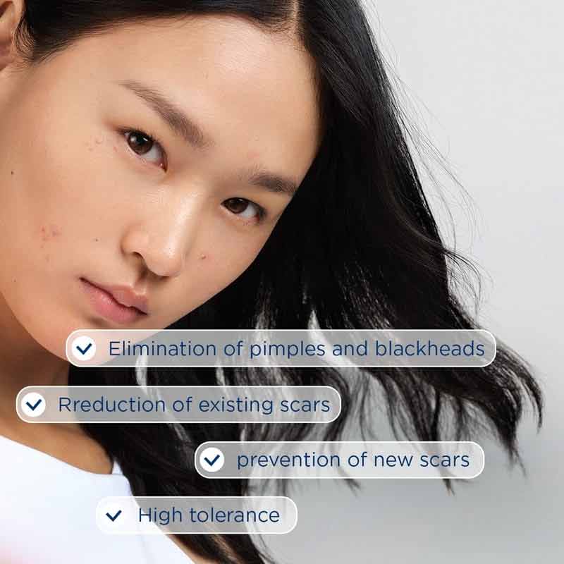 Bioderma Sebium Kerato+ Anti-Blemish High Tolerance Gel-Cream Benefits