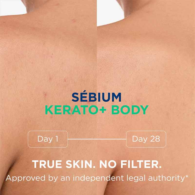 Bioderma Sebium Kerato+ Body Spray Before & After