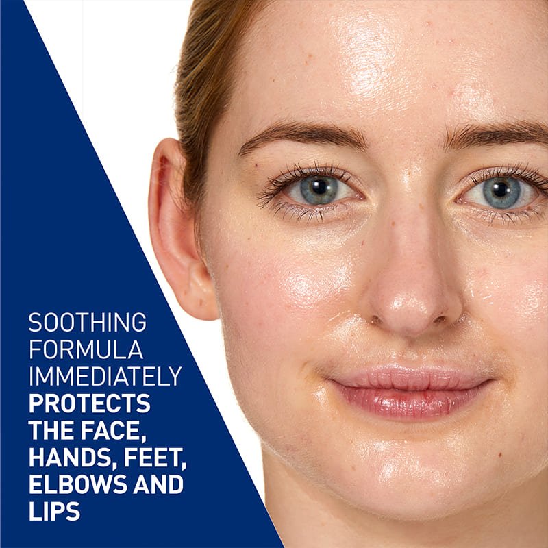 CeraVe, Advanced Repair Ointment, Formulated for Very Dry, Cracked Skin, Lightweight Formula with Ceramides and Hyaluronic Acid, Absorbs Easily, Soothing Relief, Instant Long-Lasting Hydration, Locks in Moisture, Non-Greasy Feel