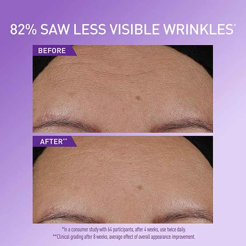 CeraVe Skin Renewing Super Boost Serum before & after forehead wrinkles