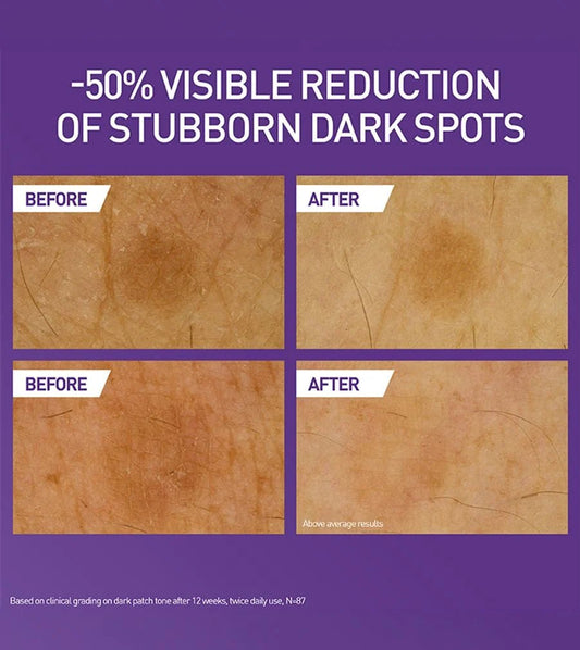 CeraVe Vitamin C Brightening Lotion before and after of two dark spotexamples with a fifty percent decrease in visibility