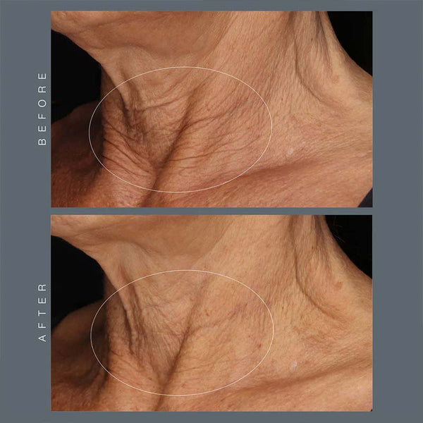 Dermalogica Neck Fit Contour Serum | neck contour | wrinkles | fine lines | vegan skincare | serum | face serum 
