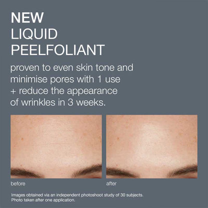 Dermalogica | Liquid | Peelfoliant | smooths | evens | skin tone | professional-grade | peel | fine lines | minimize pores