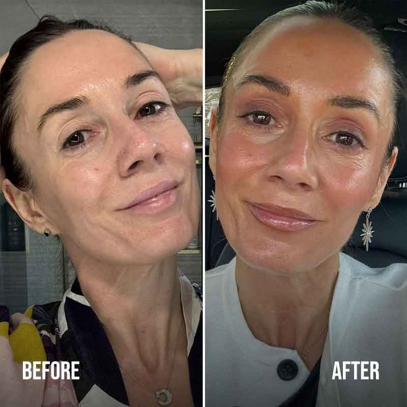 Dripping Gold Face Tanning Serum Before & After