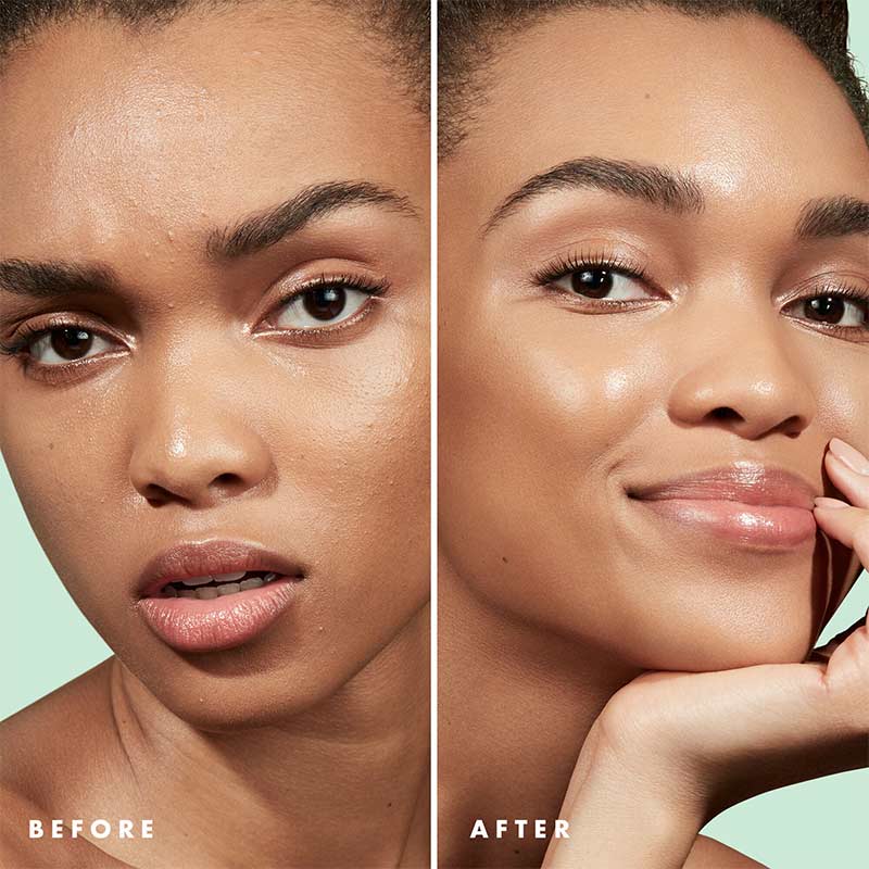 e.l.f. Blemish Control Primer Clear | before and after using blemish control primer