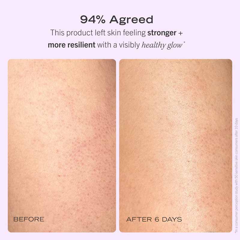 First Aid Beauty After Shower Nourishing Body Oil Before & After