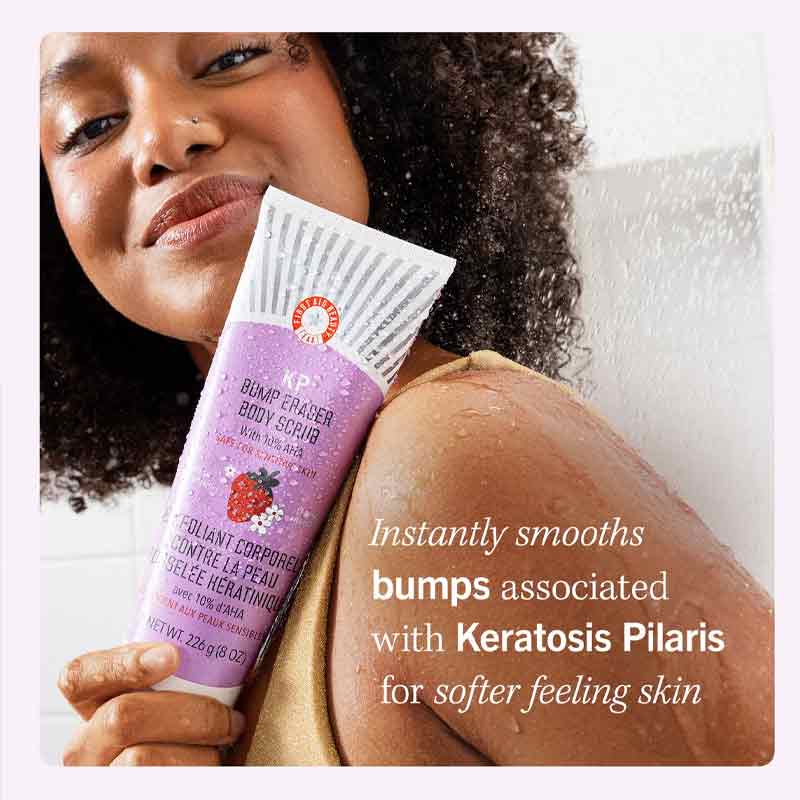 First Aid Beauty KP Bump Eraser Body Scrub, bumpy skin, bump smoothing body scrub
