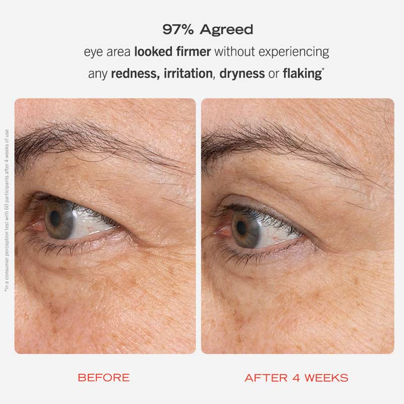 First Aid Beauty | Retinol Eye Cream | Squalane | Ceramides | multi-action eye cream | hydrates skin | visibly smooths | firms delicate skin | Encapsulated Retinol Technology | slow-release retinol | gentle retinol supply | reduces fine lines | reduces wrinkles | minimal redness | minimal irritation | calms skin | soothes skin | strengthens moisture barrier | sensitive skin | under-eye care