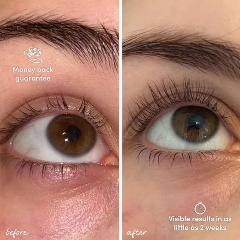 Glow For It Lash Growth Serum Results Before And After