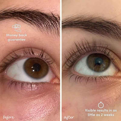 Glow For It Lash Growth Serum Results Before And After