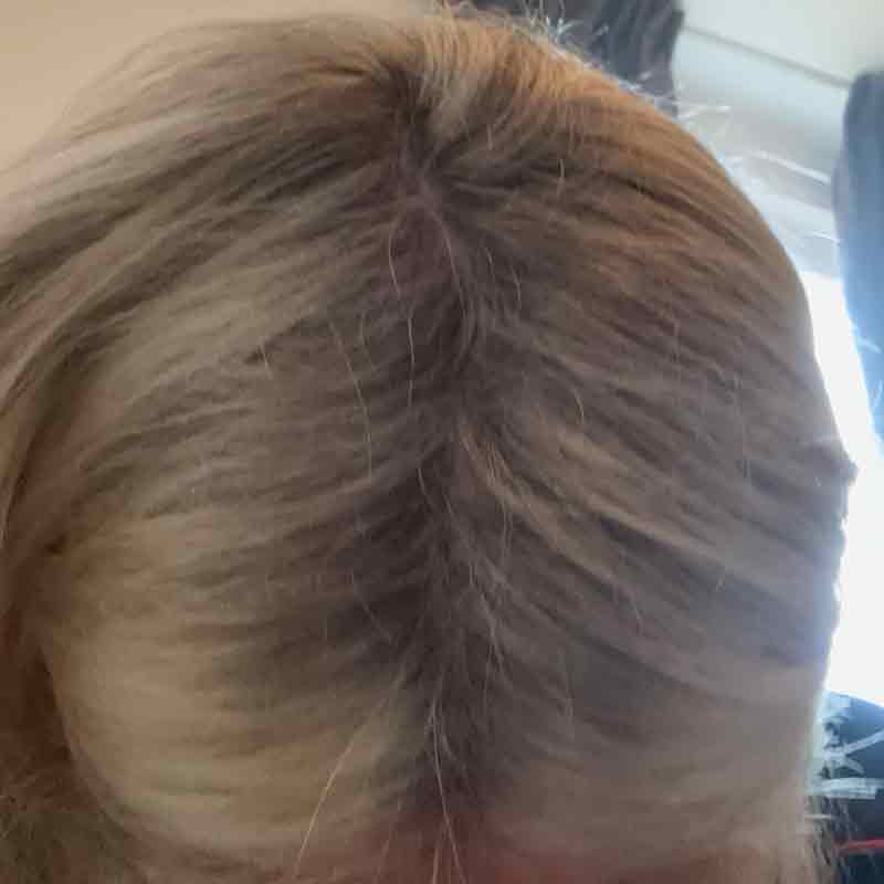 Hair Syrup Grows-Mary Pre wash Hair Oil For Thinning, Sparse Hair After Image