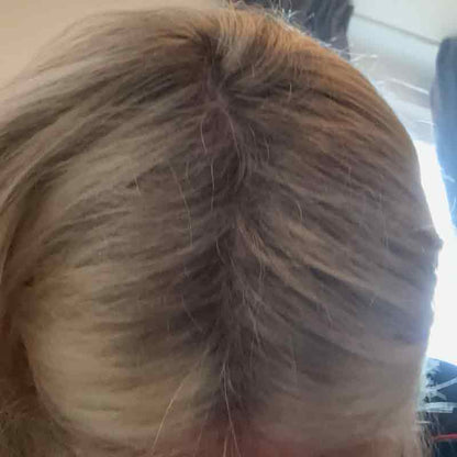 Hair Syrup Grows-Mary Pre wash Hair Oil For Thinning, Sparse Hair After Image