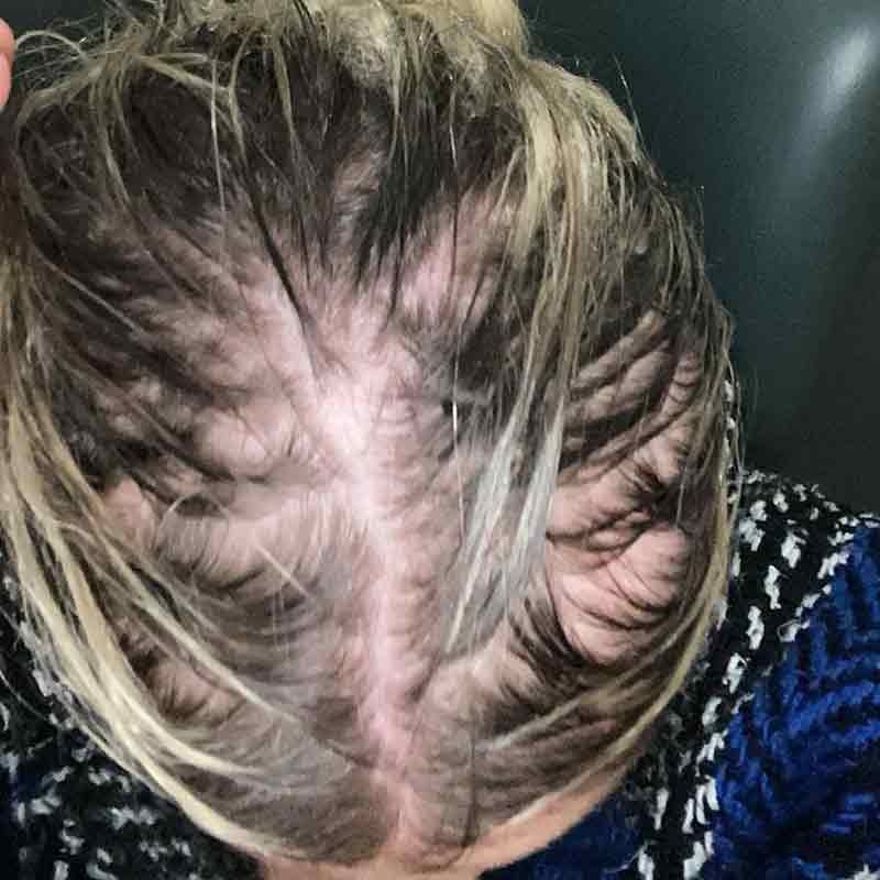 Hair Syrup Grows-Mary Pre wash Hair Oil For Thinning, Sparse Hair Before Image