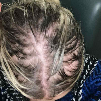 Hair Syrup Grows-Mary Pre wash Hair Oil For Thinning, Sparse Hair Before Image