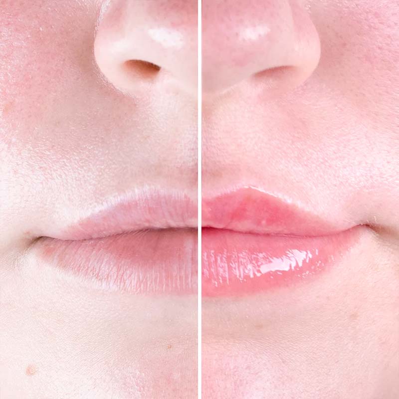 iGlow Chili Lips Lip Plumper | Lip enhancer | iGlow | Lip plumper | lip gloss | pink lip stick | pink lip gloss 